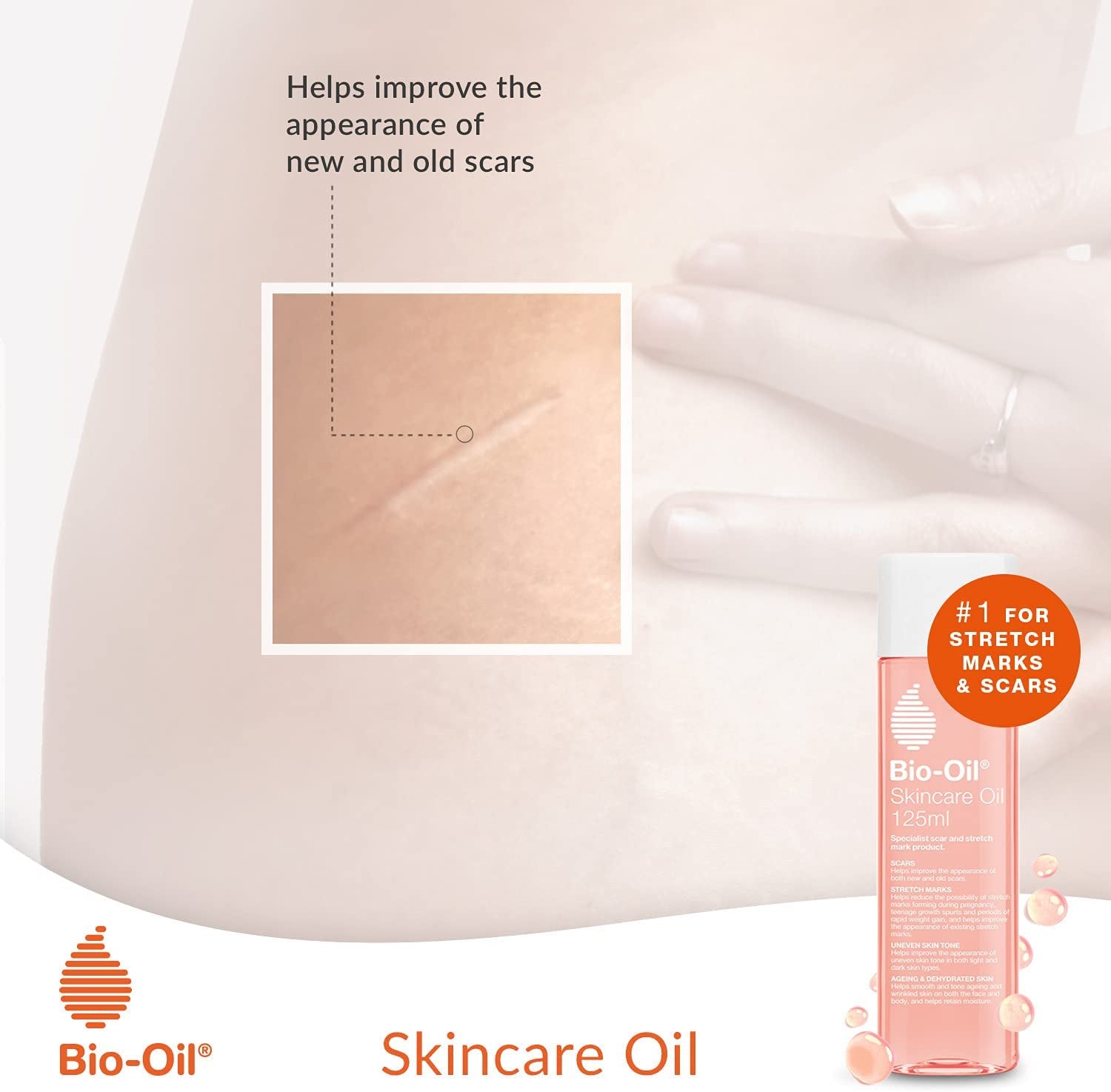 Skincare Oil - Improve the Appearance of Scars, Stretch Marks and Skin Tone - 1 X 200 Ml